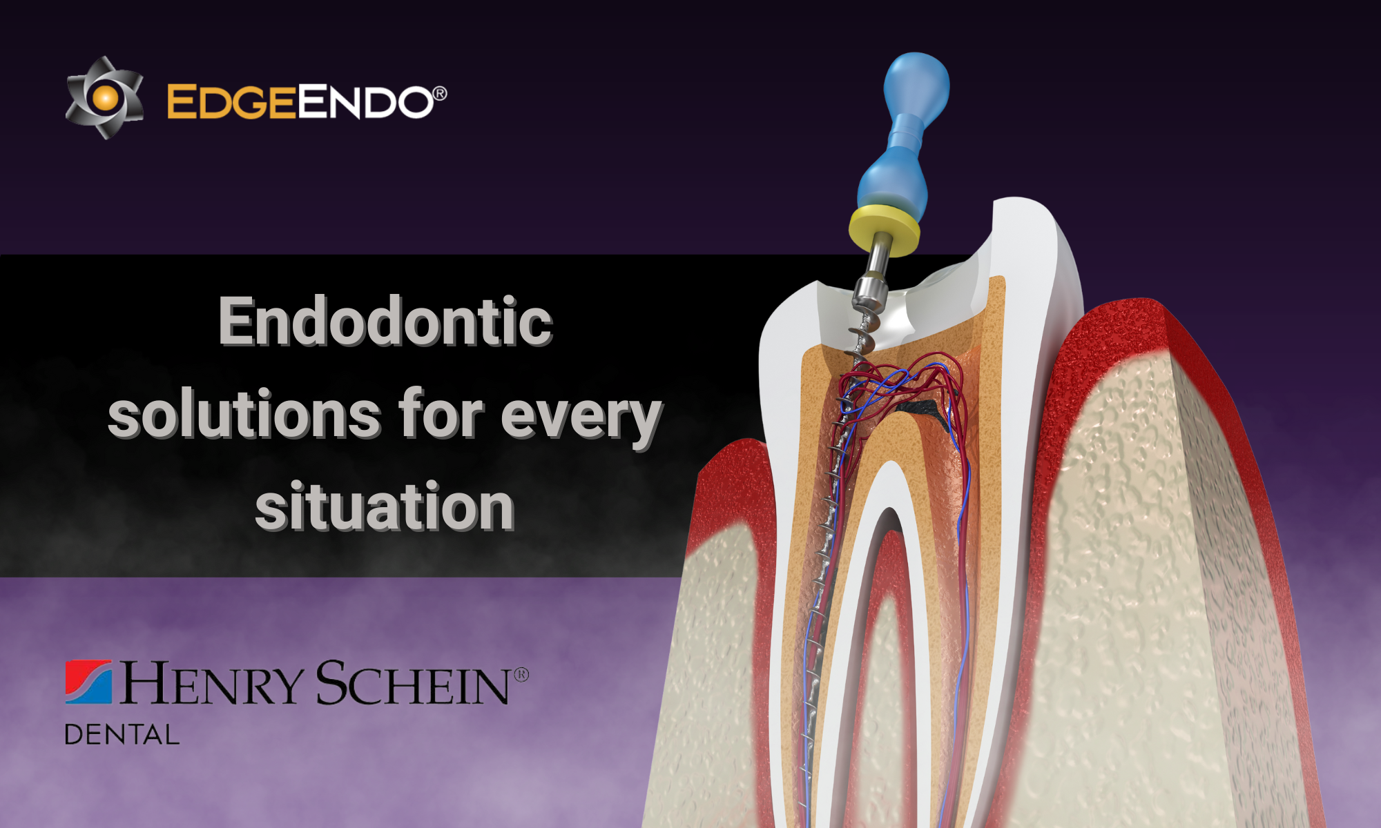 endodontics